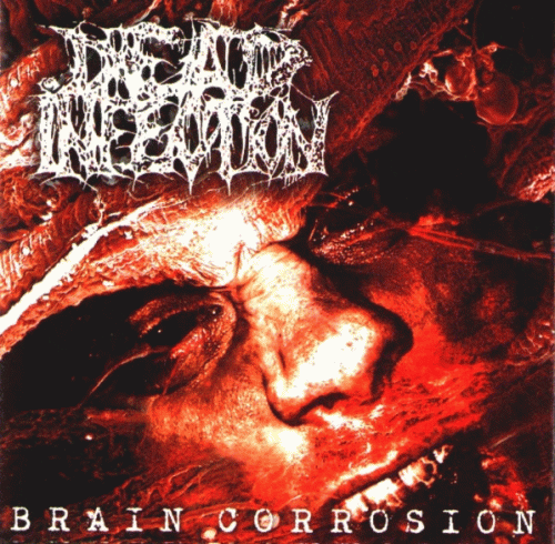Dead Infection : Brain Corrosion